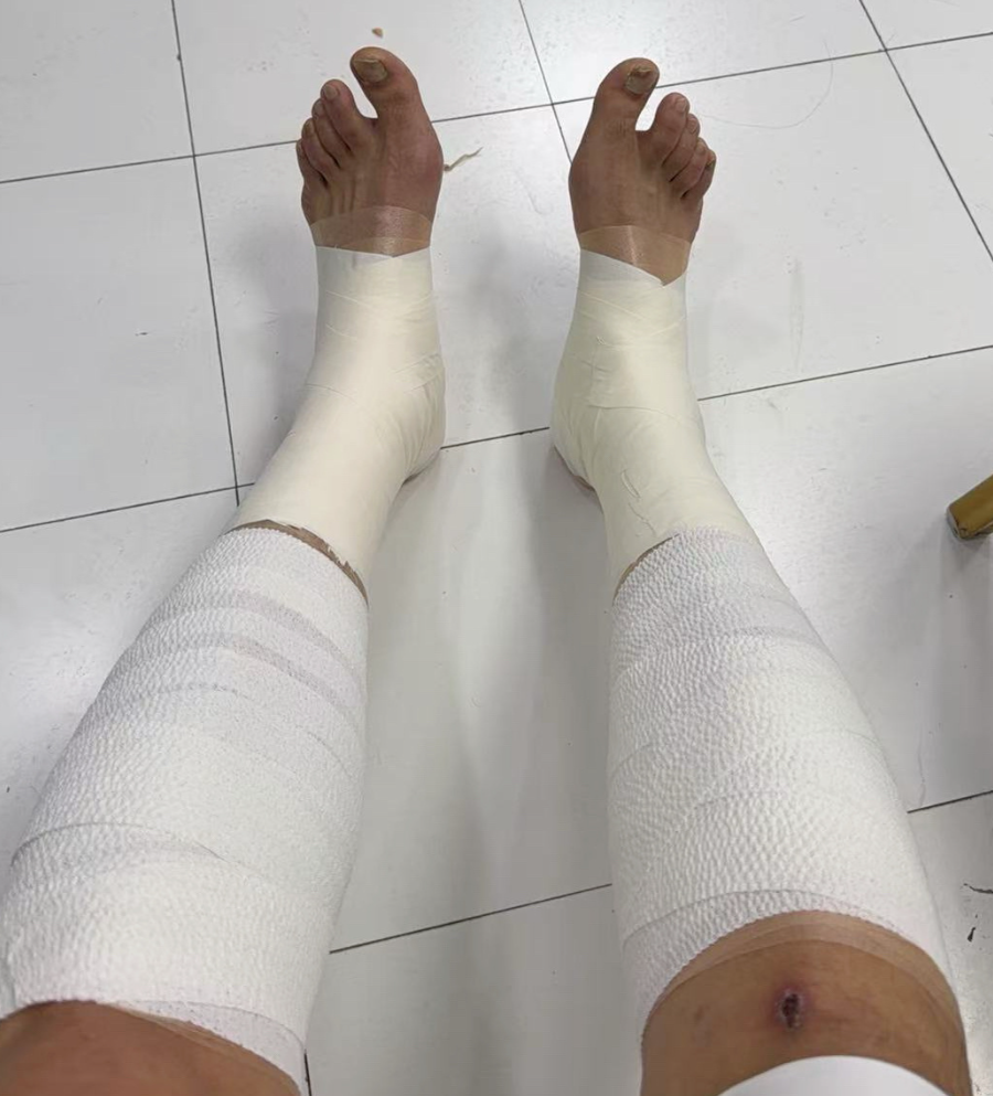 PP电子官方-胜山西谁注意翟晓川赛后伤势？双腿拉伤绑满绷带，看着都残忍！